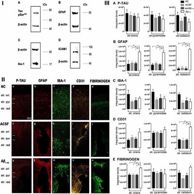 The Interplay Between Beta-Amyloid 1–42 (Aβ1–42)-Induced Hippocampal Inflammatory Response, p-tau, Vascular Pathology, and Their Synergistic Contributions to Neuronal Death and Behavioral Deficits